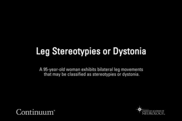 Leg stereotypies or dystonia