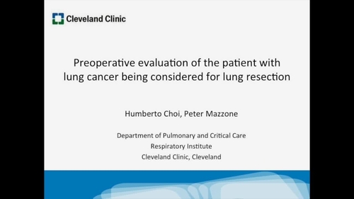 28(1) – February 2015 - Preoperative evaluation of the patient with lung cancer being considered for lung resection