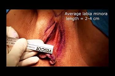 Video Gallery Plastic And Reconstructive Surgery