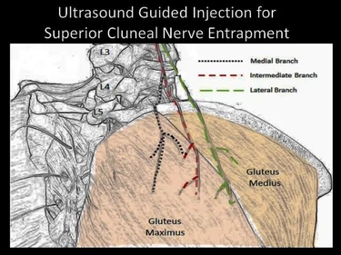 Video Gallery : American Journal of Physical Medicine ...