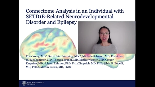 Video Abstract: Connectome Analysis in an Individual with SETD1B-Related Neurodevelopmental Disorder and Epilepsy