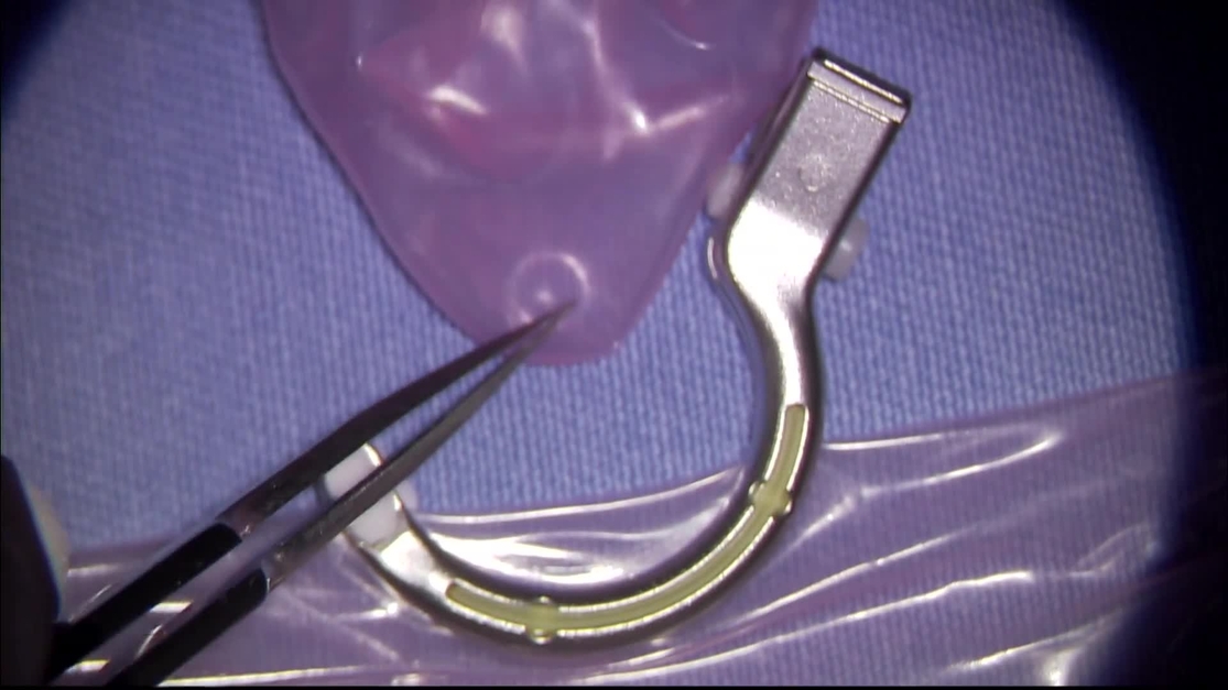 Plastic and Reconstructive Surgery – Global Open
