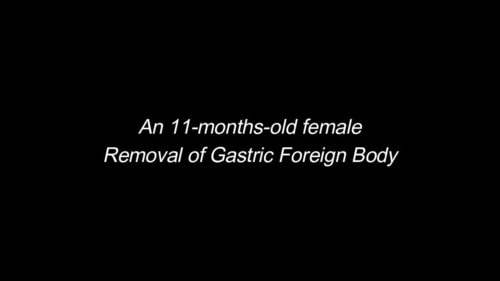 A sharp solution for a pointed problem: foreign body removal from an infant’s upper gastrointestinal tract