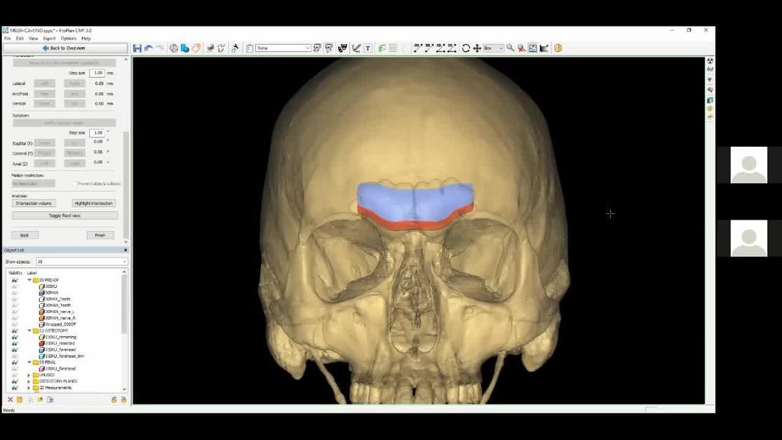 Plastic and Reconstructive Surgery – Global Open