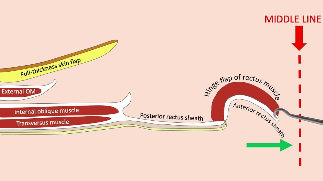 Plastic and Reconstructive Surgery Global Open