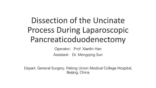 Dissection of the Uncinate Process During Laparoscopic Pancreaticoduodenectomy