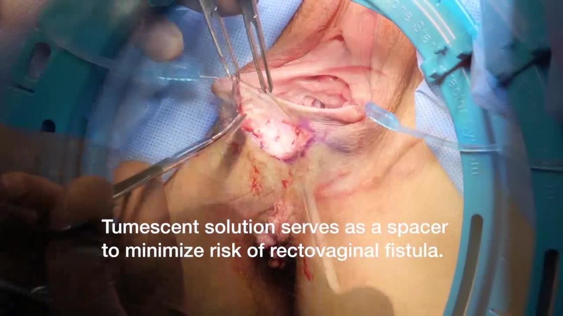 Ommaviy porno Chexiya