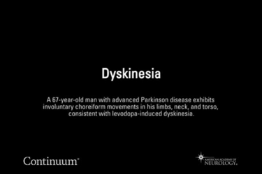 Dyskinesia