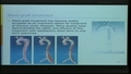 Image for Flow structures and wall shear stress patterns in the thoracic aorta