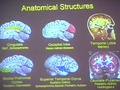 Image for Paths Towards Understanding the Shapes of the Whole Brain