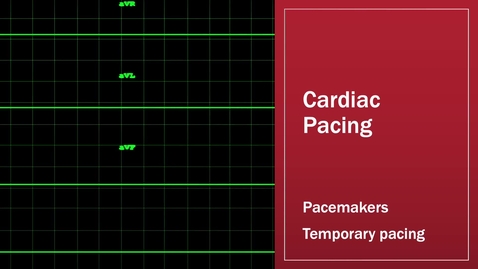 Thumbnail for Cardiac Pacing 2.0