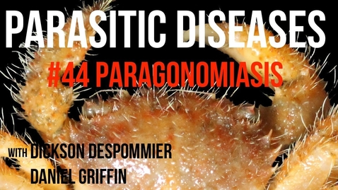 Thumbnail for entry Parasitic Diseases Lectures #44: Paragonomiasis - Quiz