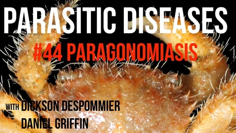 Thumbnail for Parasitic Diseases Lectures #44: Paragonomiasis - Quiz