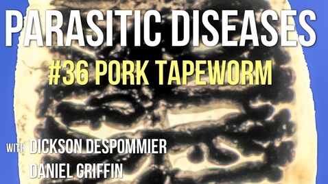 Thumbnail for entry Parasitic Diseases Lectures #36: Pork Tapeworm - Quiz