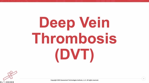 Thumbnail for Unit 10 Recorded Lecture Part 4 DVT and Varicose Veins