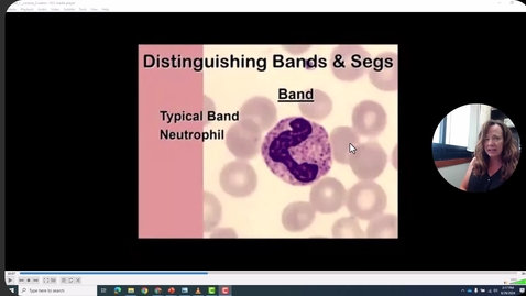 Thumbnail for Differences in Chromatin