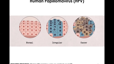 Thumbnail for MICR1153_11-17_HPV_Twing
