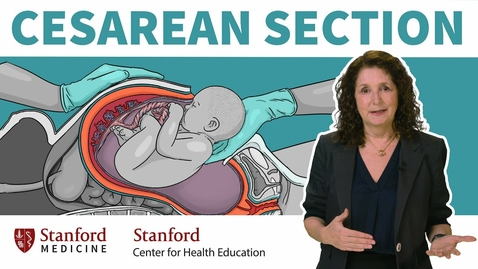 Thumbnail for entry HTHS 1101 F12-03 Cesarean Section Video with Questions
