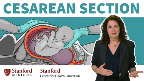 Thumbnail for HTHS 1101 F12-03 Cesarean Section Video with Questions