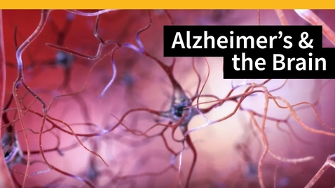 Thumbnail for entry HTHS 2231 Nervous Pre-Lab: Alzheimer Disease Video with Questions