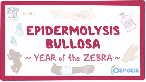 Thumbnail for Lab 7: Make Up Epidermolysis Bullosa Video with Questions