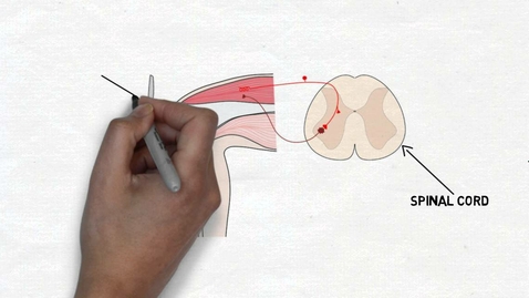 Thumbnail for HTHS 1111 F12-10a: Knee-Jerk Reflex Video with Questions