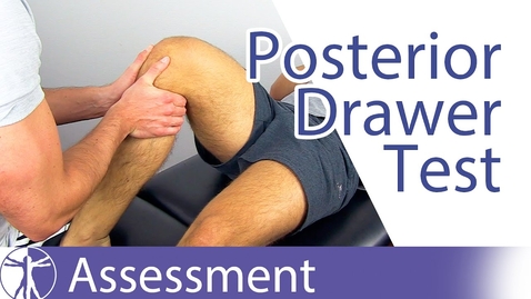Thumbnail for Posterior Drawer Test | Posterior Cruciate Ligament