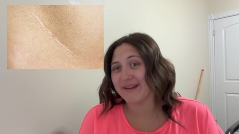 Thumbnail for Scar Resubmission