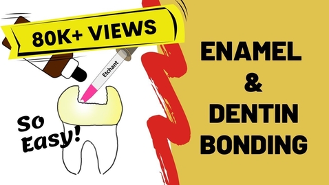 Thumbnail for Enamel and Dentin Bonding Simplified - Quiz