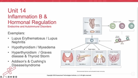 Thumbnail for Unit 14 Recorded Lecture Part 1 Lupus