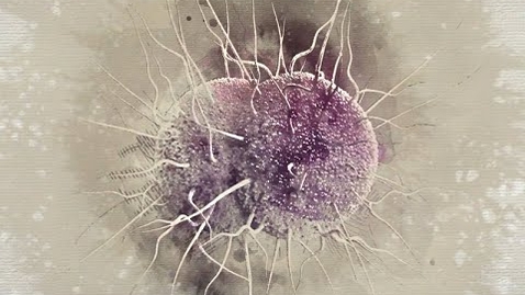 Thumbnail for Drug-Resistant Gonorrhea: An Urgent Public Health Issue