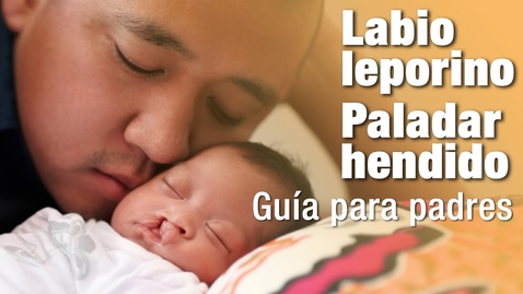 Thumbnail for Labio leporino y paladar hendido: guía para padres | AAP