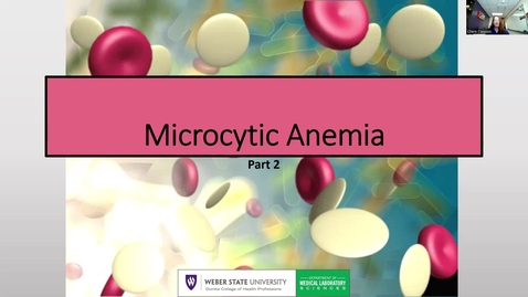 Thumbnail for entry Microcytic Anemia Part 2