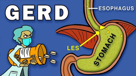 Thumbnail for entry HTHS 2230 Digestive: Gastroesophageal Reflux Disease (GERD) Video with Questions