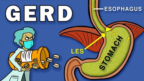 Thumbnail for HTHS 2230 Digestive: Gastroesophageal Reflux Disease (GERD) Video with Questions