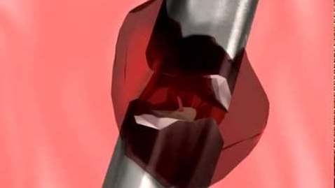 Thumbnail for Lab 9: Make Up How Does Bone Heal Video with Questions