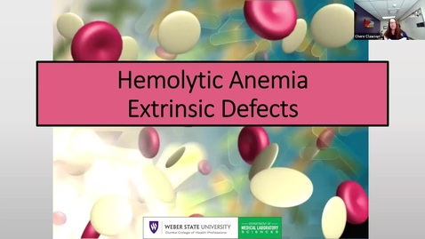 Thumbnail for entry Hemolytic Anemia Extrinsic Defects and Hypoproliferative Anemias