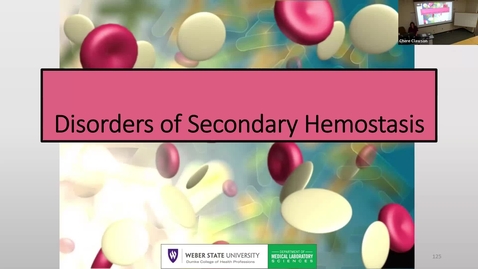 Thumbnail for 11 Disorders of Secondary Hemostasis 2025 Part 2
