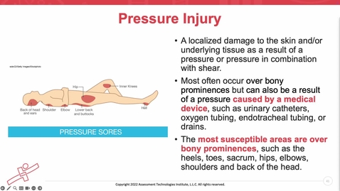 Thumbnail for Unit 12 Recorded Lecture Part 2 Pressure Injuries