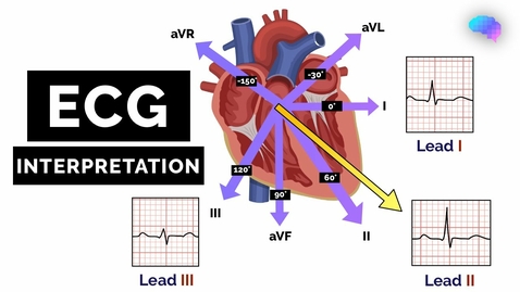 Thumbnail for entry HTHS 2231 Cardiovascular: ECG Interpretation Video with Questions