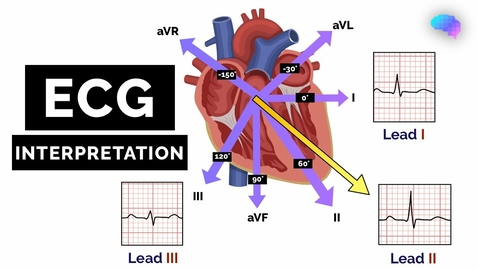 Thumbnail for HTHS 2231 Cardiovascular: ECG Interpretation Video with Questions