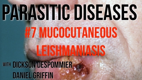Thumbnail for entry Parasitic Diseases Lectures #7: Mucocutaneous Leishmaniasis - Quiz