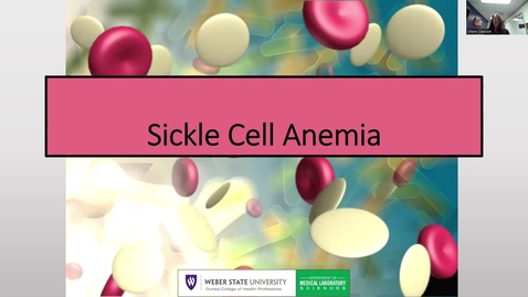 Thumbnail for entry Sickle Cell Anemia