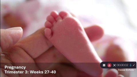 Thumbnail for NRSG6250EcholsTPregnancyUnpacked10.5.25