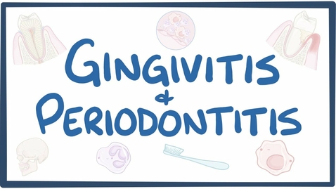 Thumbnail for entry Gingivitis and periodontitis - causes, symptoms, diagnosis, treatment, pathology - Quiz