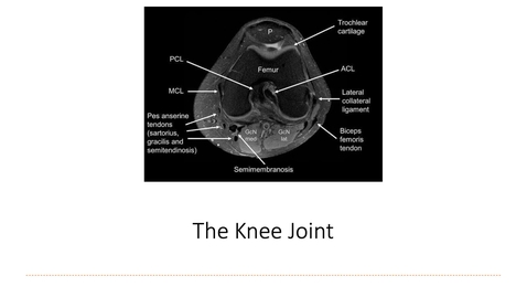 Thumbnail for Chapter 9 Knee Lecture