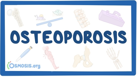 Thumbnail for Musculoskeletal F1: Calcium Homeostasis and Osteoporosis Video with Questions