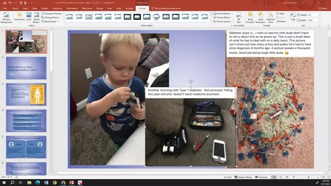 Thumbnail for Endocrine A: T1DM