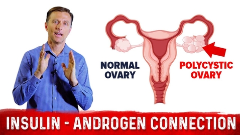 Thumbnail for Why Does Insulin Cause PCOS (Polycystic Ovary Syndrome)? – Dr.Berg