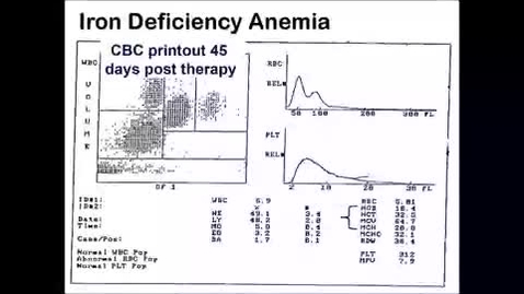 Thumbnail for Unit_2__Lecture_6
